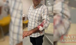 GÜNCELLEME - Hatay'da sahipsiz köpeklerin saldırdığı kişi yaralandı