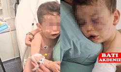 2 yaşındaki bebeğe işkence! Hayati tehlike altında!