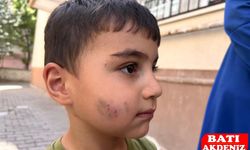 Küçük Çocuğu Uyurken Lağım Faresi Isırdı