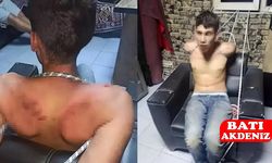 Antalya’da Genç İşçiye İnsanlık Dışı İşkence: 20 Yıl Hapis İstemi