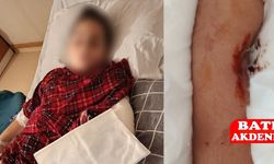 Okulda Akran Zorbalığı: Küçük Çocuk Ameliyata Alındı