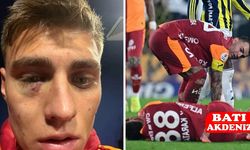 Derbide Çirkin Saldırı: Kazımcan’a Çakmak Atan Taraftar Gözaltında!