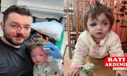 Gürültü Kavgasında 14 Aylık Bebeğin Kafatası Çatladı, 1 Tutuklama