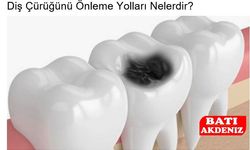 Diş Çürüğünü Önleme Yolları Nelerdir?