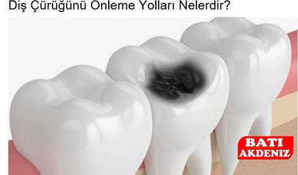 Diş Çürüğünü Önleme Yolları Nelerdir?