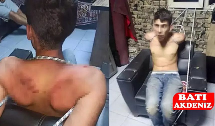Antalya’da Genç İşçiye İnsanlık Dışı İşkence
