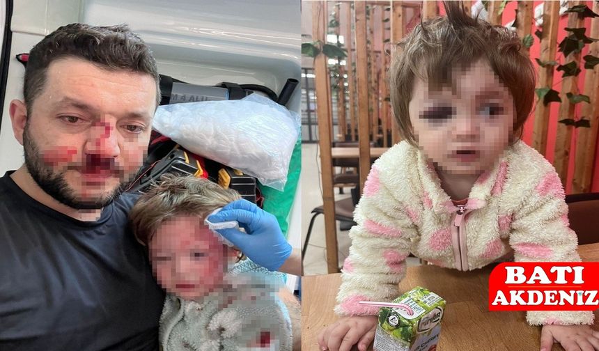 Gürültü Kavgasında 14 Aylık Bebeğin Kafatası Çatladı, 1 Tutuklama